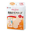 米其邦 尼基班 Atofine疤痕護理膠帶 L號 3片裝