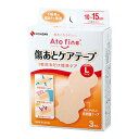 Three at-fine scar care tape L size