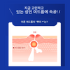 【제2류 의약품】페어아크네 크림 W