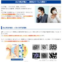 【3개 세트】【제3류 의약품】 노도누루 스프레이 대용량 25ml
